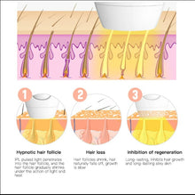 Load image into Gallery viewer, IPL Laser Hair Removal - Black_4
