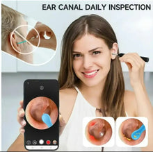 Load image into Gallery viewer, Earwax Remover with Camera_2
